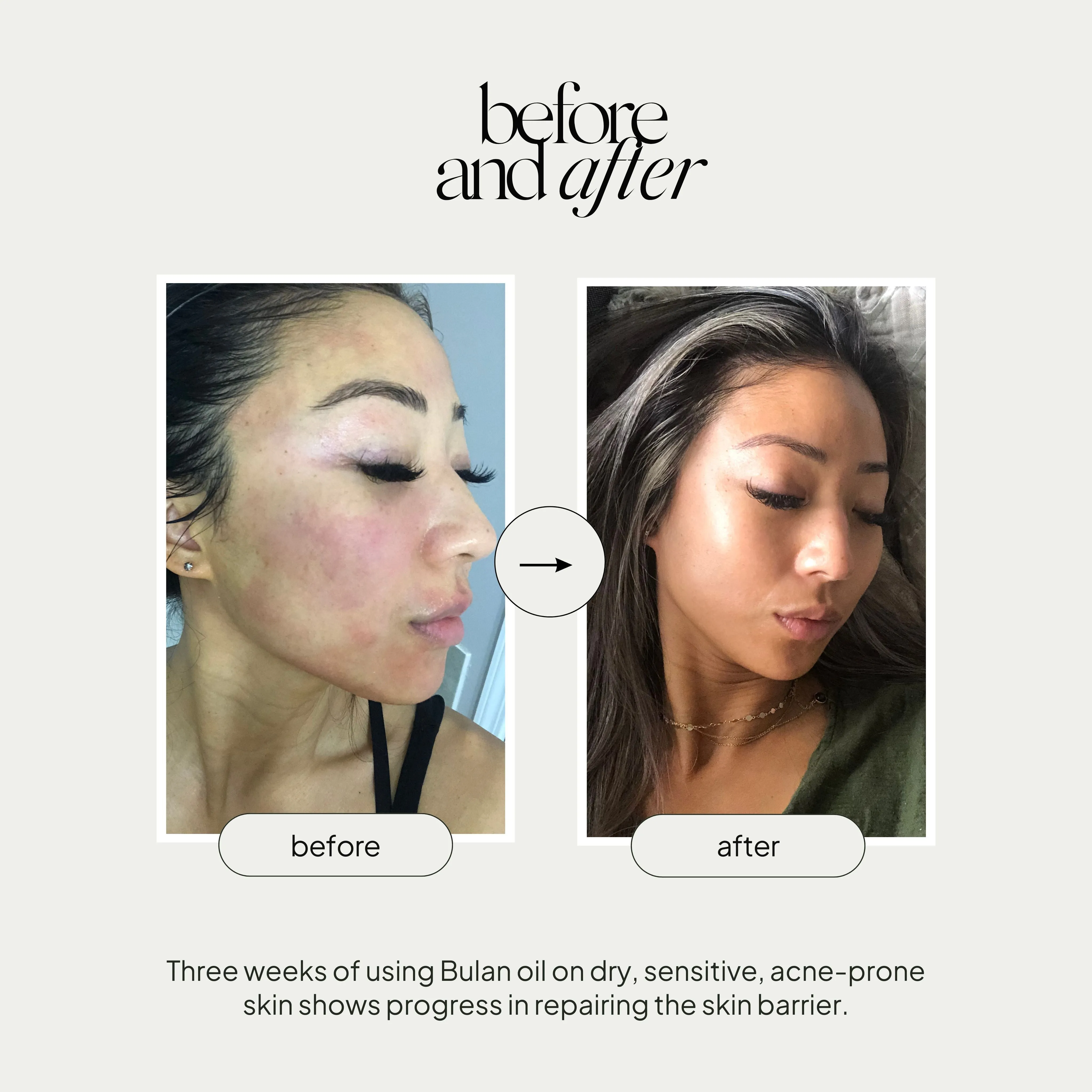 Bulan Nourishing Facial Oil